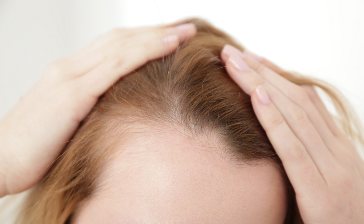 Hair Transplant Image 11