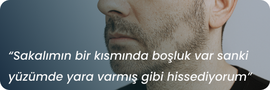 Sakal Dökülmesi Nasıl Durdurulur Görseli
