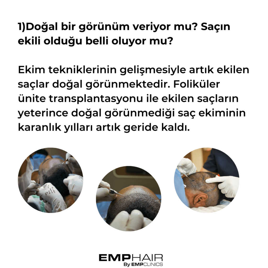 Saç Ekimi Hakkında Merak Edilen Sorular